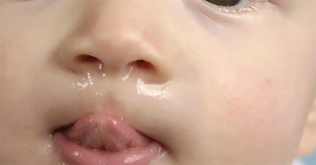 Заложен нос густые сопли. Зелёные сопли у ребёнка фото. Как текут слюни у ребенка при прорезывании зубов.